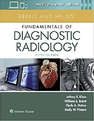Fundamentals of Diagnostic Radiology Brant and Helms - 2 Vol