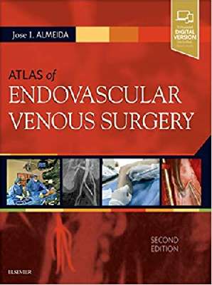 Atlas of Endovascular Venous Surgery