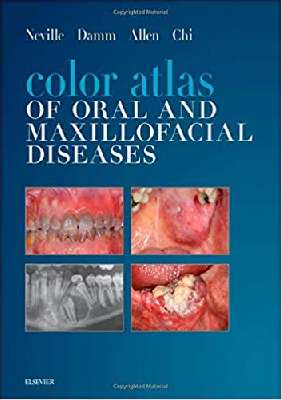 Color Atlas of Oral and Maxillofacial Diseases