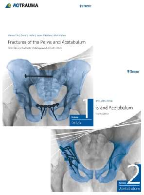 Fractures of the Pelvis and Acetabulum 
