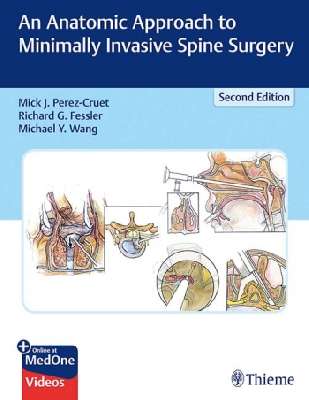 An Anatomic Approach to Minimally Invasive Spine Surgery