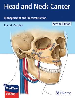 Head and Neck Cancer