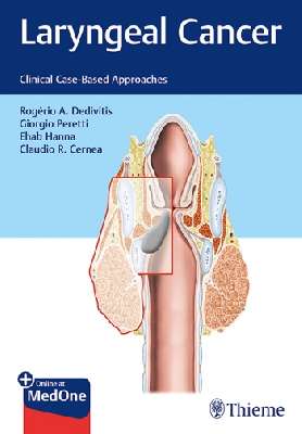 Laryngeal Cancer