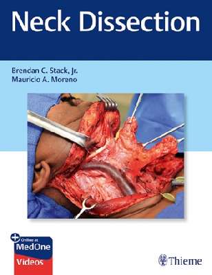 Neck Dissection