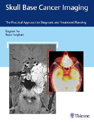 Skull Base Cancer Imaging