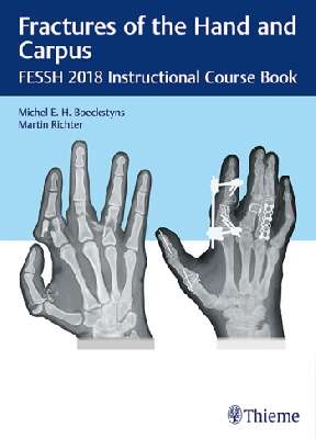 Fractures of the Hand and Carpus