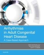 Arrhythmias In Adult Congenital Heart Disease