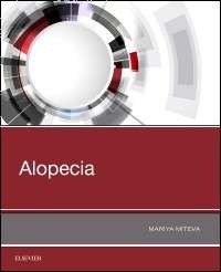 Alopecia