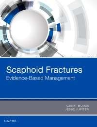 Scaphoid Fractures: Evidence-Based Management