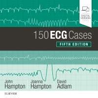 150 ECG Cases