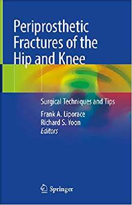 Periprosthetic Fractures of the Hip and Knee