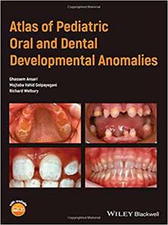 Atlas of Pediatric Oral and Dental Developmental Anomalies