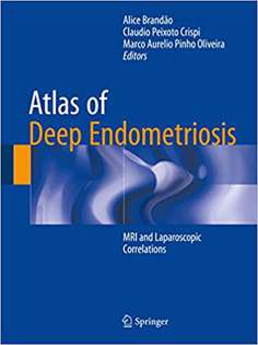 Atlas of Deep Endometriosis: MRI and Laparoscopic Correlations 