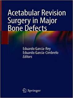 Acetabular Revision Surgery in Major Bone Defects