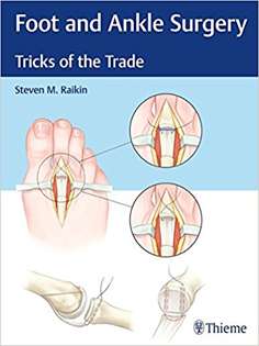 Foot and Ankle Surgery: Tricks of the Trade