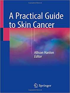 A Practical Guide to Skin Cancer