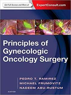 Principles of Gynecologic Oncology Surgery 