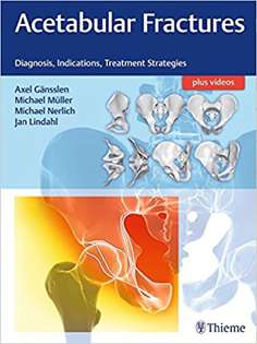 Acetabular Fractures: Diagnosis, Indications, Treatment Strategies