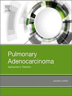 Pulmonary Adenocarcinoma: Approaches to Treatment 