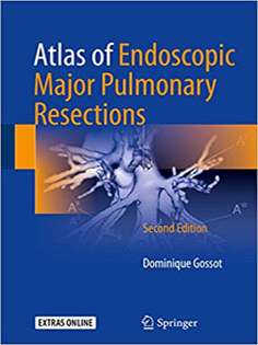 Atlas of Endoscopic Major Pulmonary Resections