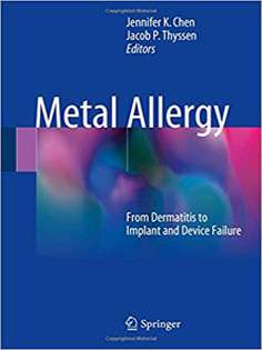 Metal Allergy: From Dermatitis to Implant and Device Failure