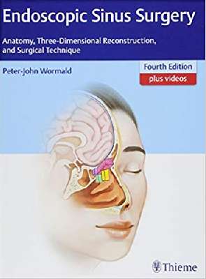 Endoscopic Sinus Surgery: Anatomy, Three-Dimensional Reconstruction, and Surgical Technique