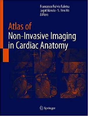 Atlas of Non-Invasive Imaging in Cardiac Anatomy