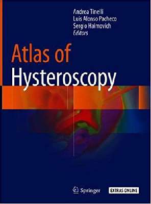 Atlas of Hysteroscopy