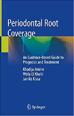 Periodontal Root Coverage: An Evidence-Based Guide to Prognosis and Treatment