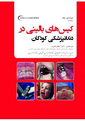 کیس های بالینی در دندانپزشکی کودکان