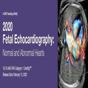  Fetal Echocardiography Normal and Abnormal Hearts