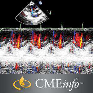 Echocardiography – A Comprehensive Review