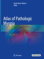 Atlas of Pathologic Myopia