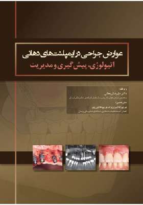 عوارض جراحی در ایمپلنت های دهانی اتیولوژی، پیشگیری و مدیریت