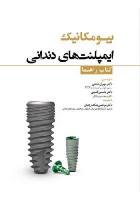 بیومکانیک ایمپلنت های دندانی