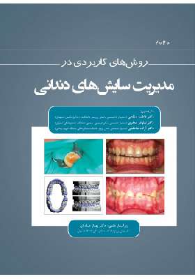 روش های کاربردی در مدیریت سایش های دندانی 2020