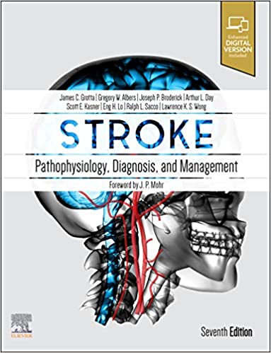 Stroke: Pathophysiology, Diagnosis, and Management