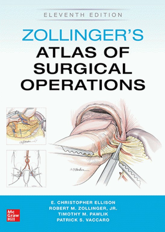 Zollinger's Atlas of Surgical Operations 2021