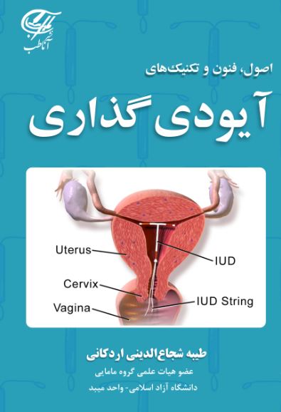 اصول، فنون و تکنیکهای آیودی گذاری