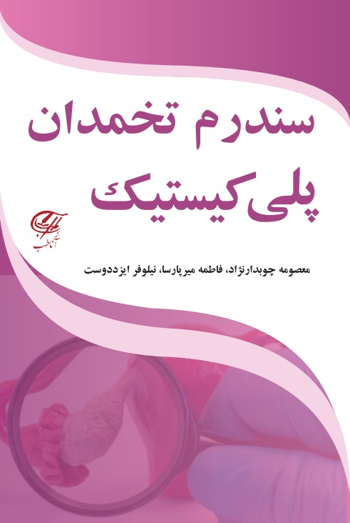 سندرم تخمدان پلی کیستیک