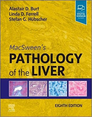 Pathology of the Liver MacSween`s