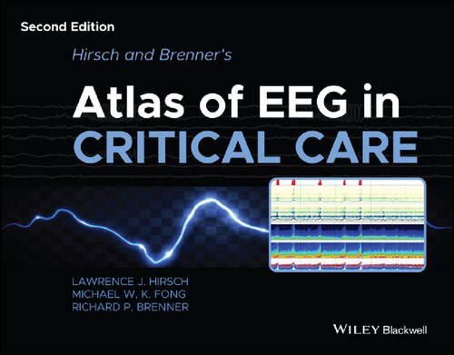 Hirsch and Brenner's Atlas of EEG in Critical Care